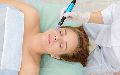 Skin Needling Therapy Port Melbourne